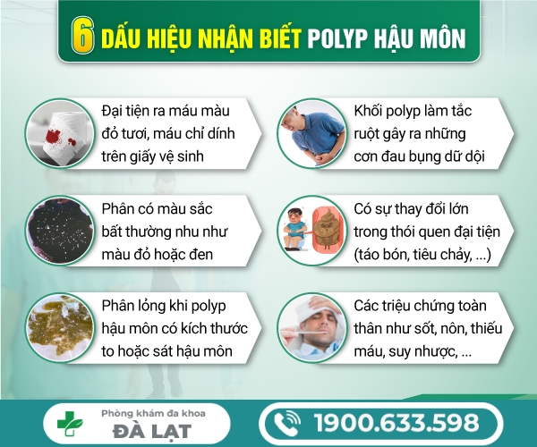 Hình ảnh minh họa